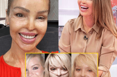 “I Had to Learn to See the World Differently” – Katie Piper’s Agonizing Journey to Reclaim Her Face, Her Sight, and Her Life